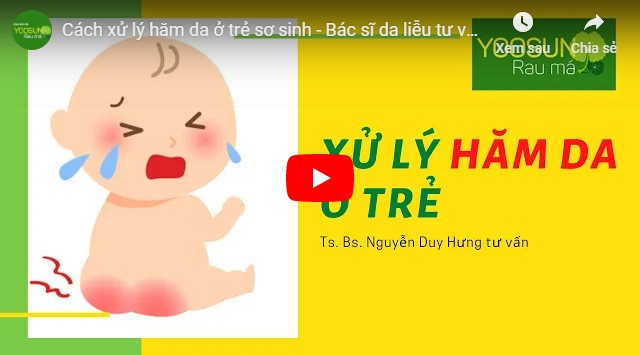 Video cách trị hăm háng cho bé