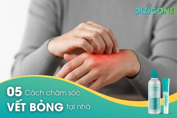 cach-chua-bong-tai-nha cách chữa bỏng tại nhà