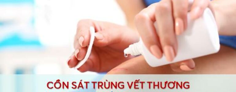 Cồn sát trùng vết thương - Hại nhiều hơn lợi - Dizigone