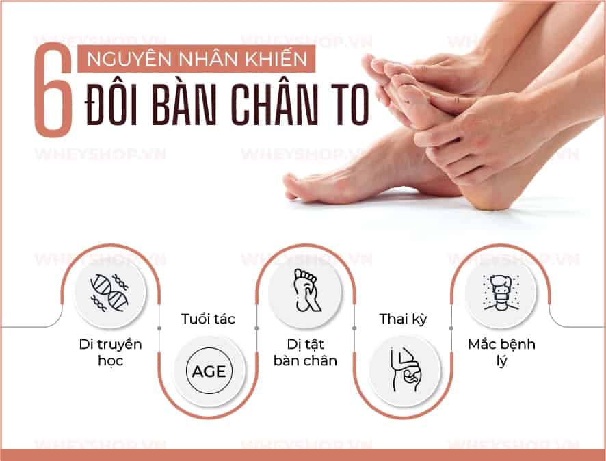 Bạn là người có đôi bàn chân cỡ đại khiến bạn rất xấu hổ. Để đáp ứng mong muốn thay đổi đôi bàn chân nhỏ nhắn hơn, WheyShop bật mí cách làm bàn chân nhỏ lại nhé