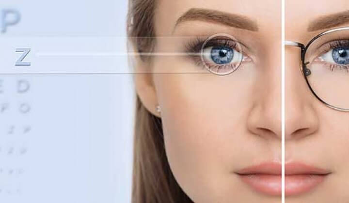 Công nghệ mổ mắt Lasik