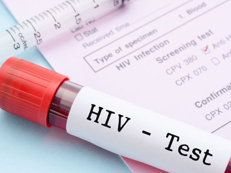 Chưa tìm ra biện pháp chữa dứt điểm HIV