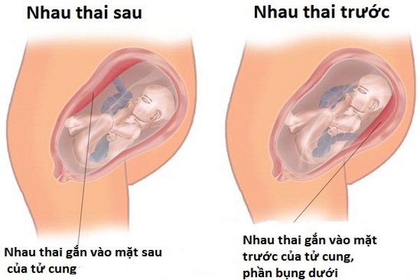 Rau bám mặt trước là trai hay gái?