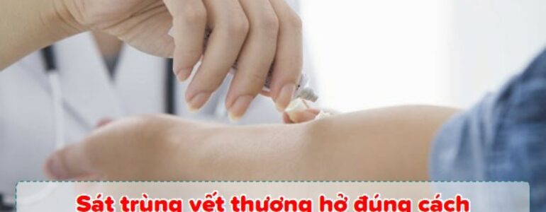 Sát trùng vết thương hở tại nhà đúng cách bằng 6 bước đơn giản