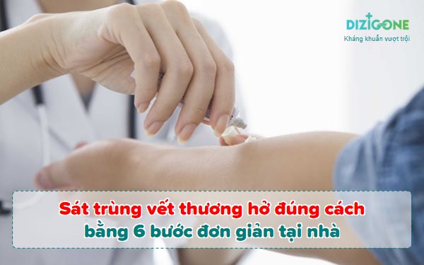 sat_trung_vet_thuong_ho sát trùng vết thương hở