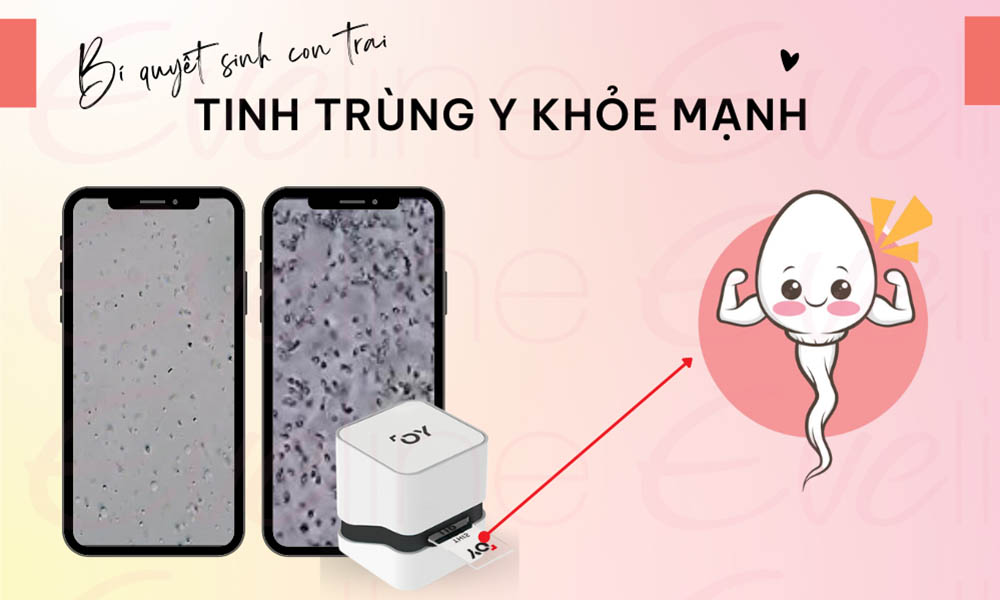 Muốn sinh con trai tinh trùng Y phải khỏe