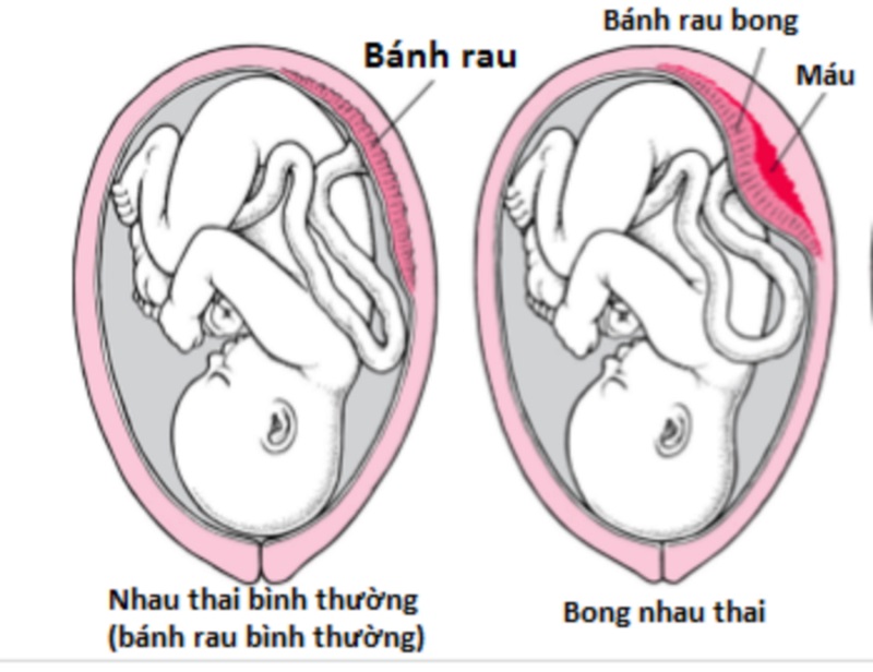 Sự liên kết đặc biệt giữa mẹ và bé thông qua nhau thai