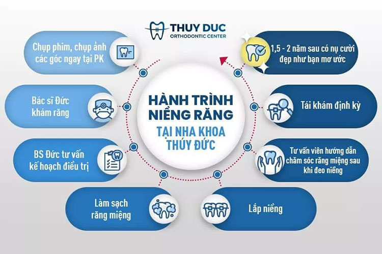 Quy trình niềng răng tại Nha khoa Thúy Đức 1