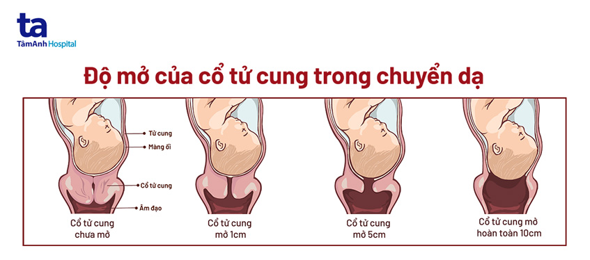 các đường cắt tầng sinh môn