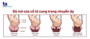 ảnh hưởng đến tâm lý của vợ chồng