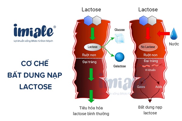 Cơ chế bất dung nạp lactose