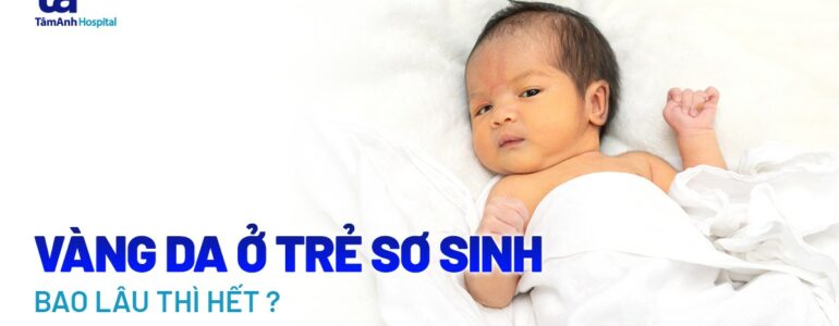 Vàng da ở trẻ sơ sinh bao lâu thì hết? 1 tuần hay 1 tháng?